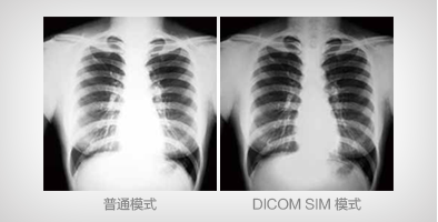 DICOM 模式 - Epson CB-Z9875U产品功能