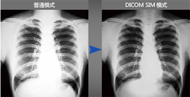 DICOM SIM模式 - Epson EB-C301MN产品功能