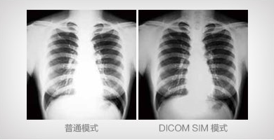 DICOM SIM 模式 - Epson EB-C754XN产品功能